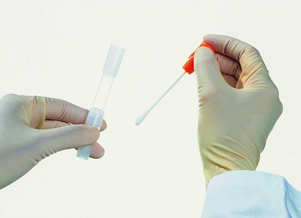 Collection of analyzes to detect chronic prostatitis