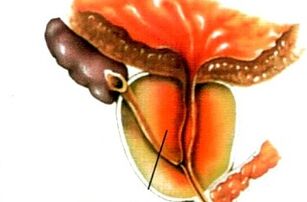 What is prostate in men
